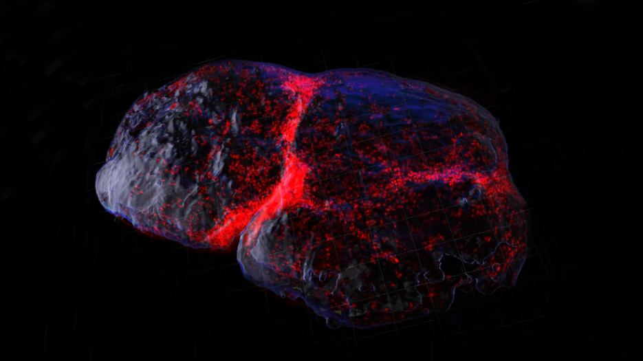 staining of a lab image of immune cells in a lymph node